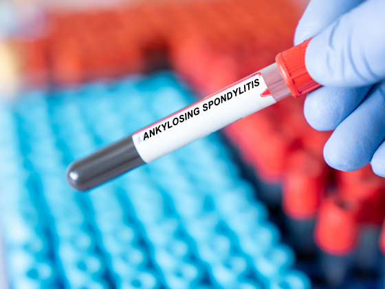 치료 방법 일러스트